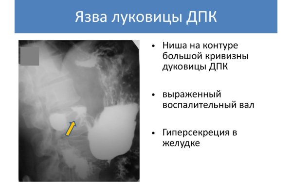 Ссылка на кракен не работает